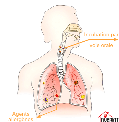 Schéma d'une voie respiratoire et des poumons attaqué par le mérule